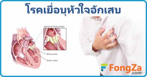 เยื่อบุหัวใจอักเสบ โรคหัวใจอักเสบ ติดเชื้อในกระแสเลือด 