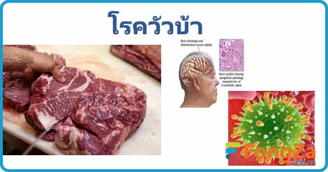 โรควัวบ้า สารพรีออน โรคติดต่อ โรคติดเชื้อ