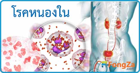 หนองใน โกโนเรีย โรคติดต่อ